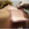 Smith & Nephew - Allevyn® - Adhesive Dressing - 66020043 - In Use