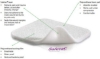 Mölnlycke - Mepilex® - Foam Dressing - 294199 - Product Details