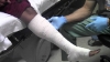 Dynarex® - Unna Boot Bandage - 3453 - In Use
